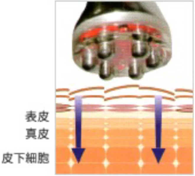 機器を当てて美容成分を皮下まで浸透させるイメージ