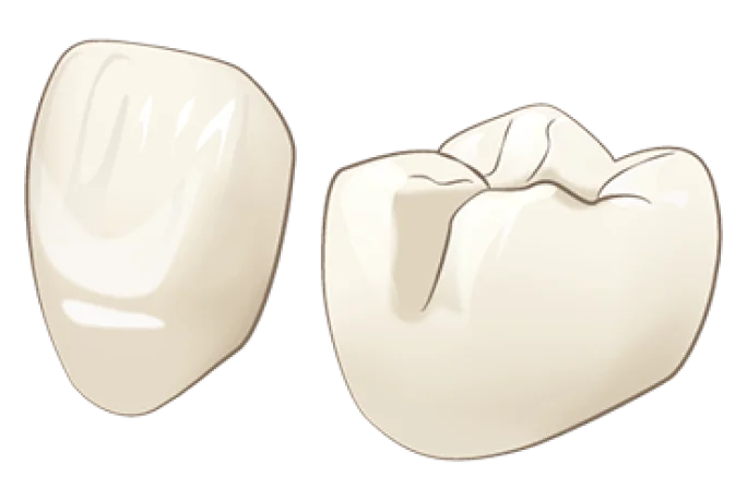 e-maxのかぶせもののイラスト