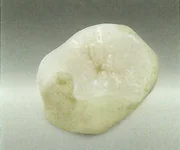 オールジルコニア