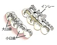 大臼歯と小臼歯に詰めたインレーのイラスト